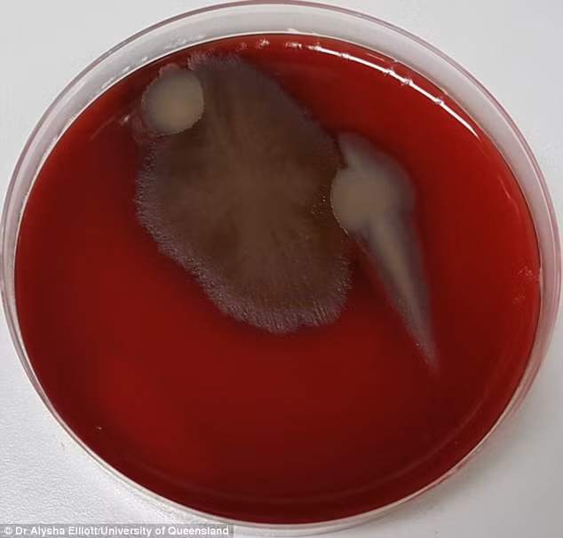 Những bề mặt xung quanh máy tính, điện thoại văn phòng, bàn phím máy tính, tay nắm cửa được phóng to chứa đầy vi khuẩn gây bệnh trong phòng làm việc.