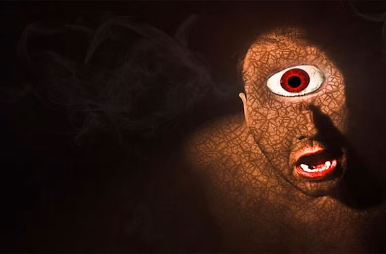 Hội chứng được đặt tên theo những quái vật thần thoại Hy Lạp nổi tiếng Cyclop. Những đứa trẻ chào đời với hội chứng cyclopia có một mắt duy nhất nằm giữa đầu.