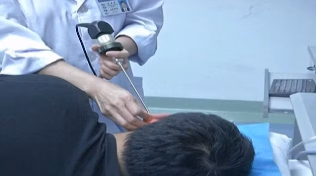 Nổi gai ốc clip hàng trăm con giòi ký sinh trong tai Noi gai óc clip hang tram con gioi ký sinh trong tai