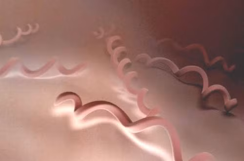 Bệnh giang mai (Syphilis) là bệnh lây truyền qua đường tình dục do xoắn khuẩn nhạt, tên là Treponema pallidum gây nên. Xoắn khuẩn vào cơ thể qua chỗ da và niêm mạc bị xây xát thường là do tiếp xúc trực tiếp do giao hợp, đường sinh dục, đường hậu môn hoặc đường miệng. Từ đó xoắn khuẩn đi vào hạch và 1 vài giờ sau nó đi vào máu và lan truyền khắp cơ thể.