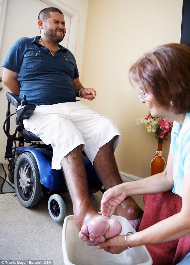 Các bác sĩ cho rằng chứng bệnh hiếm này bị gây ra bởi đột biến gen AKT1 - gen quy định sự tăng trưởng của tế bào. Đột biết khiến cho một số tế bào cơ thể phát triển và phân chia bất thường.