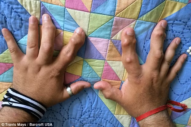 Các bác sĩ đã đồng ý thực hiện phẫu thuật cắt bỏ chân cho đến khi ông này hoàn trả các chi phí phẫu thuật đầy đủ.