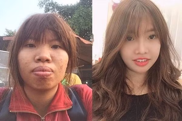 Đến thời điểm này, 6 năm sau khi công bố việc "đập đi xây lại", thay đổi 180 độ nhan sắc, Quách Phượng có cuộc sống khác hoàn toàn so với trước kia.