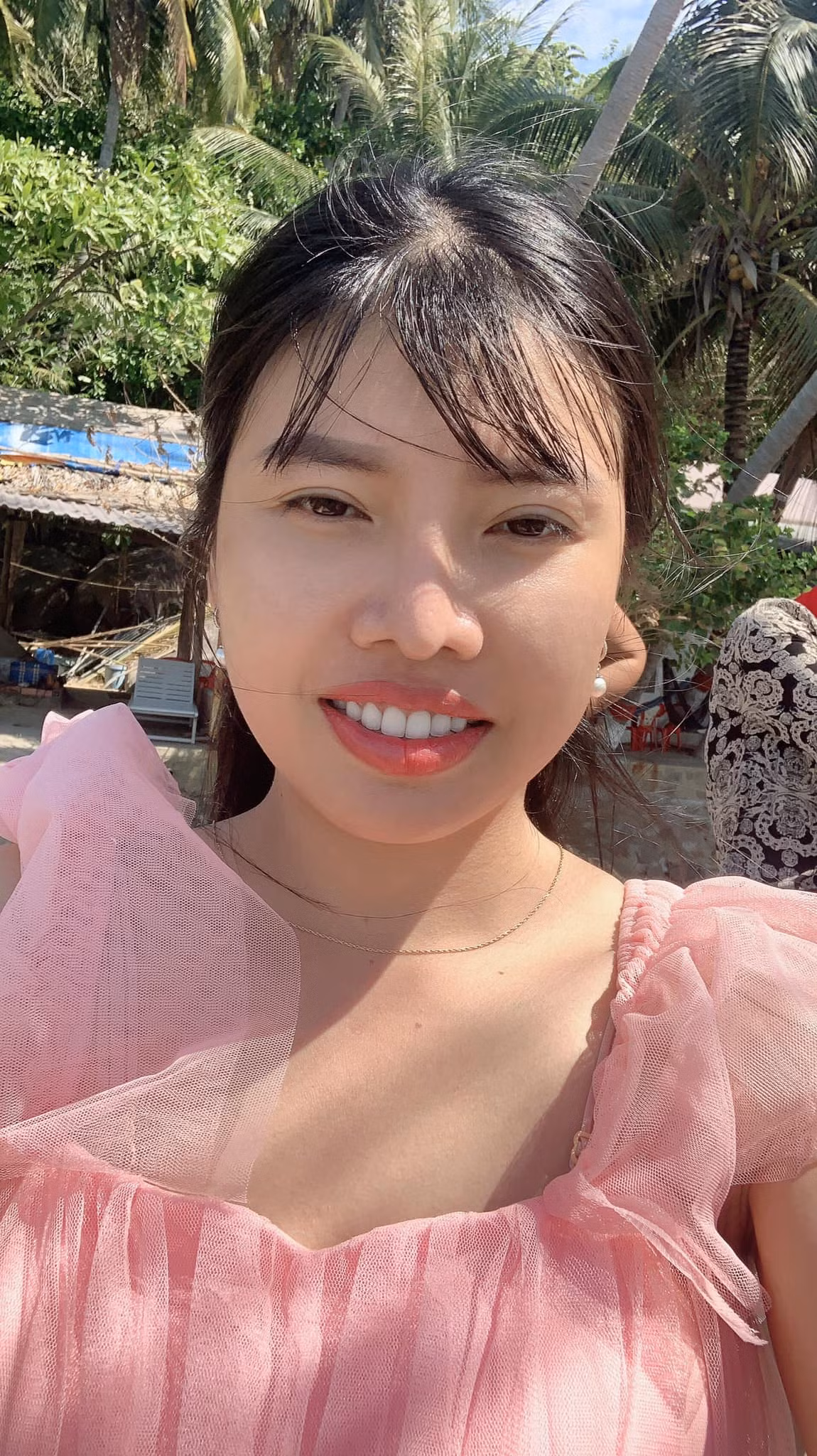 Trải qua 6 năm kể ngày thẩm mỹ, dù từng trải qua nhiều cuộc đại phẫu nhưng gương mặt cô nàng vẫn không có bất kỳ biến chứng nào, cho thấy Phượng rất nỗ lực trong việc “bảo dưỡng" nhan sắc hiện tại.