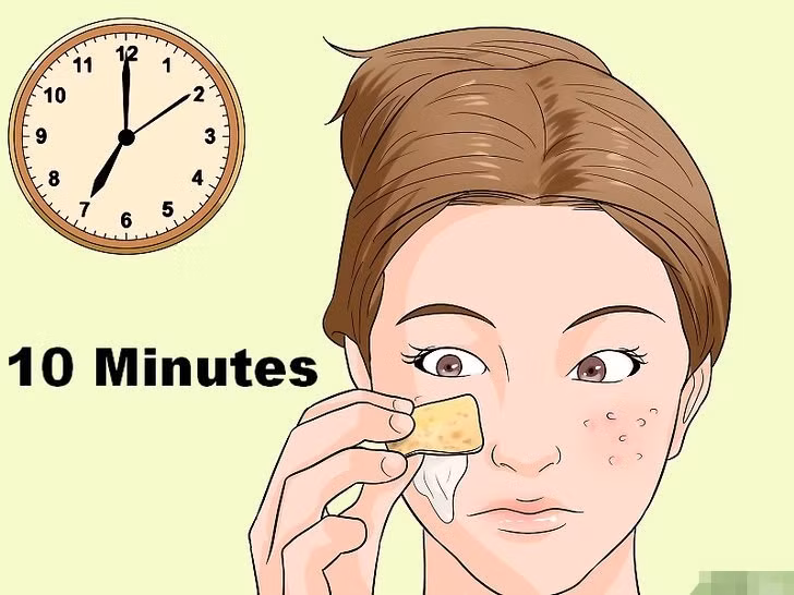 Vỏ chuối trị mụn cấp tốc - Ảnh: Internet