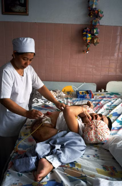 Việt, 19 tuổi, vốn là một nửa của cặp sinh đôi dính liền Việt - Đức, đang được nhân viên y tế của bệnh viện Từ Dũ làm vệ sinh. Ảnh: Chris Steele-Perkins/ Magnum Photos.