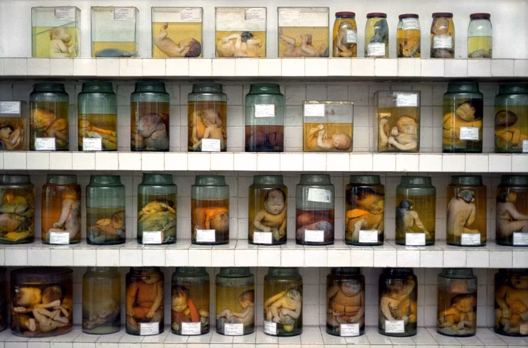 Trong phòng lưu trữ các thai nhi di tật do di chứng chất độc da ca ở Bệnh viện Từ Dũ. Ảnh: Chris Steele-Perkins/ Magnum Photos.