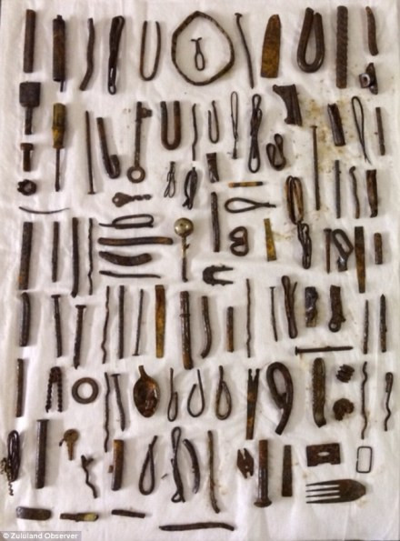 Người đàn ông 25 tuổi này mắc hội chứng Pica - hội chứng rối loạn ăn uống với đặc trưng là thèm ăn những thứ không có giá trị dinh dưỡng. Người đàn ông 25 tuổi này mắc hội chứng Pica - hội chứng rối loạn ăn uống với đặc trưng là thèm ăn những thứ không có giá trị dinh dưỡng.