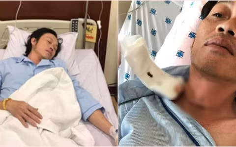 Hoai Linh ung thu tuyen giap nguy hiem the nao?