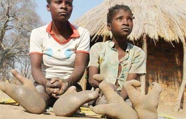 Vi sao bo lac Doma o chau Phi lai co 