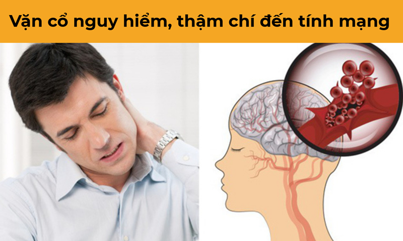 Vặn cổ rất nguy hiểm cho sức khỏe của bạn:Việc chúng ta vặn cổ từ bên nọ sang bên kia và nghe thấy tiếng "răng rắc" có thể là nguyên nhân dẫn đến việc làm vỡ các động mạch, gây nguy hiểm đến sức khỏe và tính mạng./.