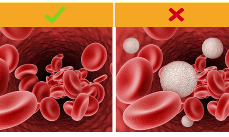 Kem chống nắng nguy hiểm hơn chúng ta nghĩ: Việc sử dụng những sản phẩm chống nắng dẫn đến sự gia tăng đáng kể các hoạt chất trong máu. Trong một số trường hợp, nó cao hơn 400 lần so với mức an toàn.