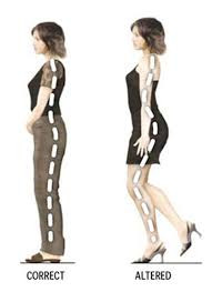 Thoái hóa cột sống, viêm xương khớp Khi sử dụng giày cao gót, ngoài các cơ bắp ở chân, lưng thì cột sống cũng hoạt động hết công suất để nâng đỡ trọng lượng cơ thể. Cụ thể, đi giày cao gót khiến độ thăng bằng của cơ thể giảm đi, đẩy trọng tâm của người về phía trước để lấy tư thế cân bằng. Tư thế này làm cho hông, cột sống và khớp gối bị lệch khỏi trục sinh lý vốn có. Điều này khiến phái nữ sẽ thấy lưng nhức mỏi, gai cột sống, dáng đi không còn thẳng đẹp.