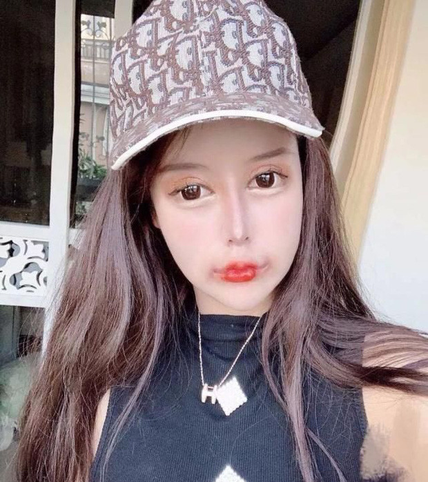 Trên mạng xã hội, Tiểu Z Na Na không ngại ngần chia sẻ những hình ảnh trước và sau khi thẩm mỹ.