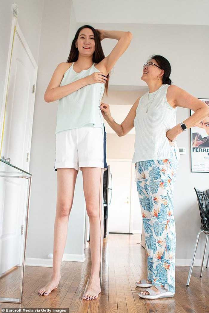 Đối với Rentsenkhorloo, cuộc sống mỗi ngày là một thách thức. Cô không thể tìm mua được size giày vừa cho mình, thường phải mua giày nam để mang. Cô cũng khó tìm thấy những bộ quần áo phù hợp trong các trung tâm thương mại nên buộc phải đặt may. Với chiều cao "khủng" như vậy, cô thường xuyên bị đập đầu vào khung cửa.