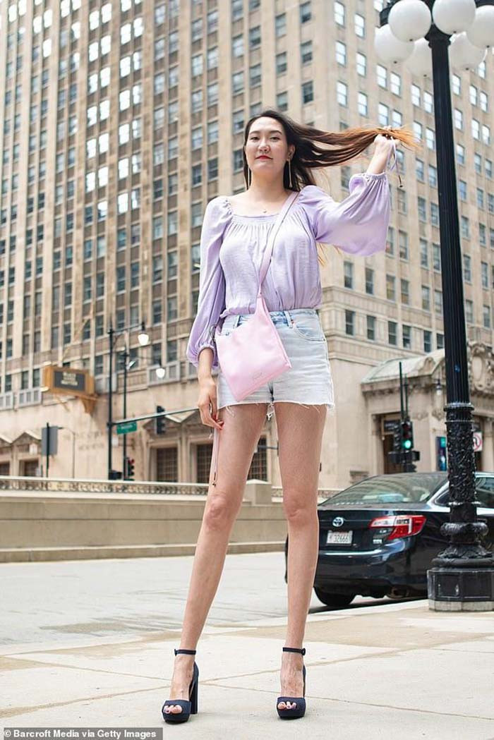 Rentsenkhorloo Bud kể lại: "Khi học lớp 1, tôi đã cao ngang ngửa giáo viên. Vì sự khác biệt này mà tôi bị phân biệt đối xử và cô lập trong lớp".