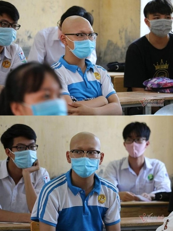 Thí sinh Quang Minh, trường THPT Mỹ Đức A - Hà Nội mắc bệnh hiểm nghèo và vừa mới vượt qua lần hóa trị thứ 5. Thế nhưng vì ước mơ đỗ vào trường Học viện Công nghệ Bưu chính Viễn thông nên chàng trai đã cố gắng hoàn thành kì thi tốt nghiệp của mình. Ảnh: Vietnamnet