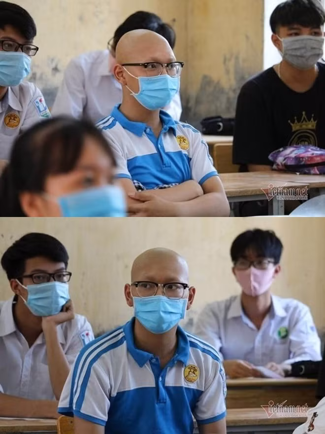Thí sinh Quang Minh, trường THPT Mỹ Đức A - Hà Nội mắc bệnh hiểm nghèo và vừa mới vượt qua lần hóa trị thứ 5. Thế nhưng vì ước mơ đỗ vào trường Học viện Công nghệ Bưu chính Viễn thông nên chàng trai đã cố gắng hoàn thành kì thi tốt nghiệp của mình. Ảnh: Vietnamnet
