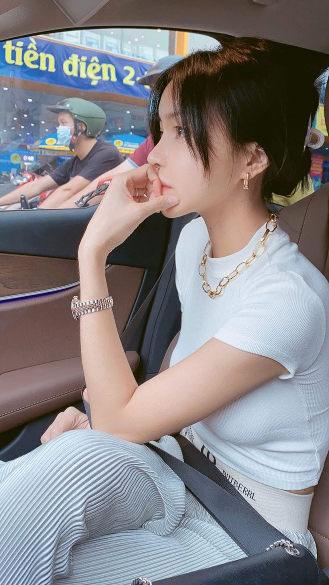 Tuy nhiên, theo lời cô chia sẻ, 6 tháng sau khuôn mặt mới ổn định và 10 tháng mới có thể ăn uống hay nói chuyện bình thường.