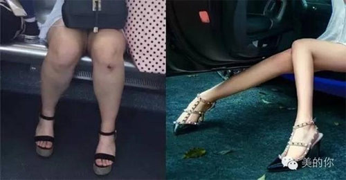 Không phải là hot girl chân dài thon thả, thực chất đôi chân của Vu Văn Tĩnh được nhiều dân mạng đánh giá là "to như chân voi".