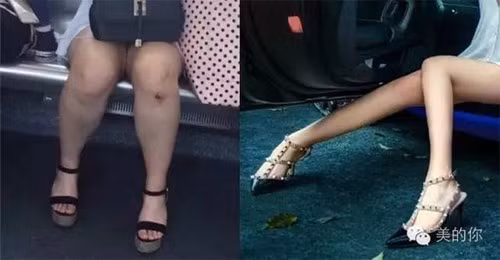 Không phải là hot girl chân dài thon thả, thực chất đôi chân của Vu Văn Tĩnh được nhiều dân mạng đánh giá là "to như chân voi".