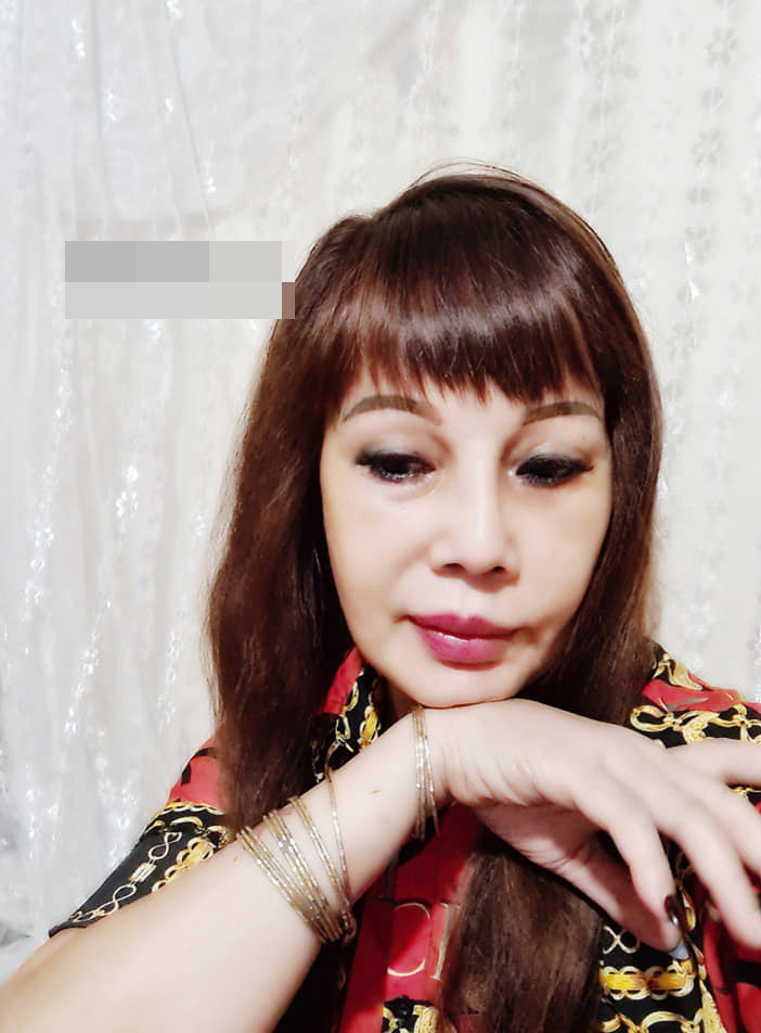 Một số tài khoản mạng đã nhận xét rằng rất có thể về sau này khuôn mặt chị Thu Sao sẽ chỉ hồi phục được một chút ít chứ không thể nào cân bằng lại 100% như lúc đầu.