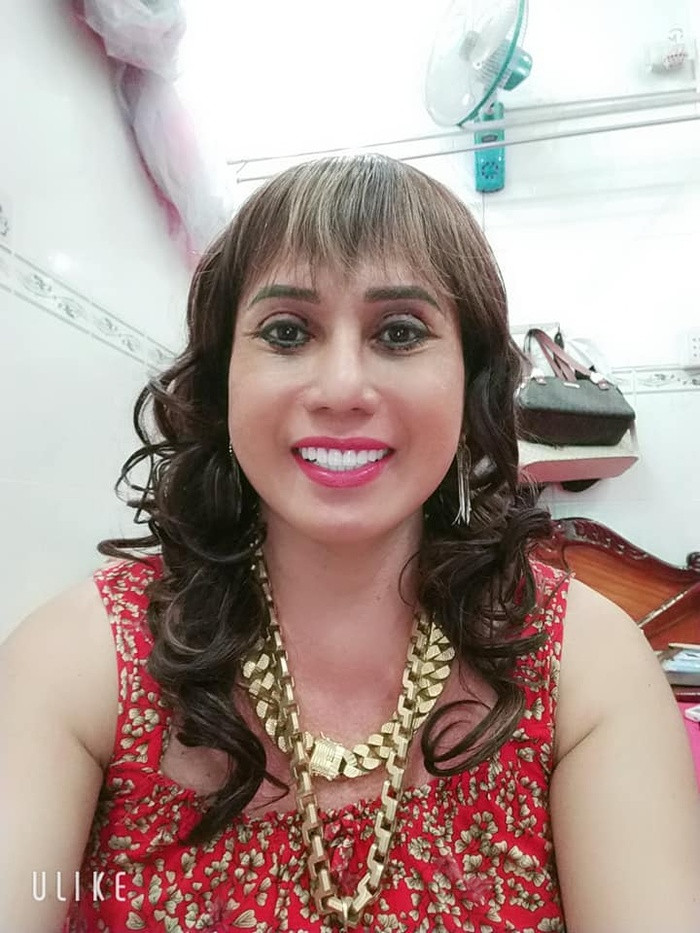 Vì mới thực hiện làm đẹp cho vùng mắt cách đây vài tuần nên vết thương chưa liền lại, gương mặt của "cô Minh Hiếu" nhìn già hơn so với trước.