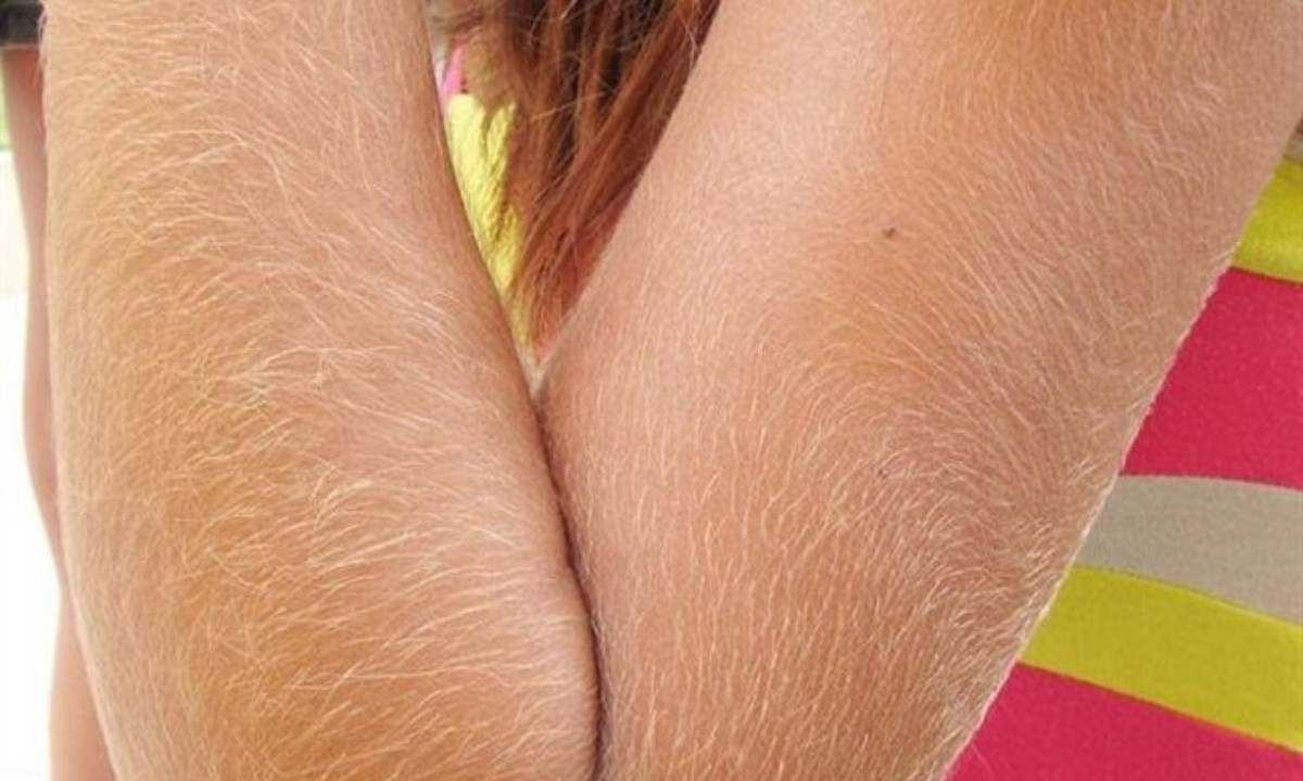 6.Số lượng lông trên cơ thể: con người trông có vẻ mịn màng và ít lông hơn so với các loài linh trưởng khác. Tuy nhiên, trên thực tế số lượng sợi lông trên cơ thể con người ngang bằng với một con tinh tinh. (Nguồn: Vinmec)