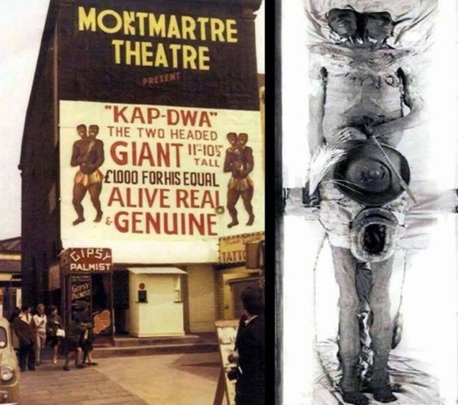 Câu chuyện về xác ướp 2 đầu khổng lồ thu hút sự quan tâm của nhiều người. Theo các giai thoại, xác ướp thuộc về người đàn ông Kap Dwa sống ở Patagonia (hiện nằm trong lãnh thổ Chile và Argentina). Đây được cho là nơi sinh sống của những người khổng lồ trong một thời gian dài.