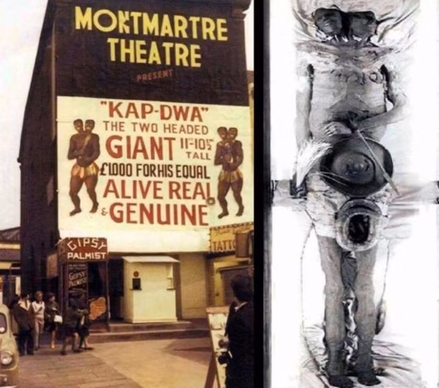 Câu chuyện về xác ướp 2 đầu khổng lồ thu hút sự quan tâm của nhiều người. Theo các giai thoại, xác ướp thuộc về người đàn ông Kap Dwa sống ở Patagonia (hiện nằm trong lãnh thổ Chile và Argentina). Đây được cho là nơi sinh sống của những người khổng lồ trong một thời gian dài.