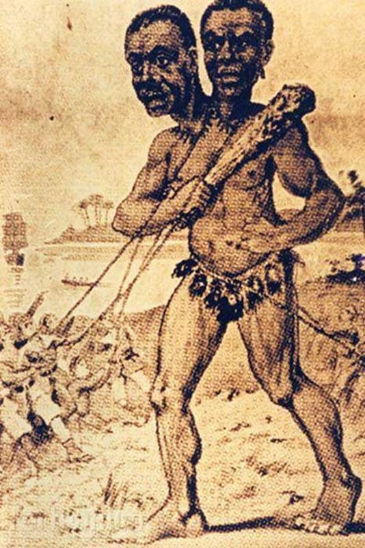 Trước những câu chuyện về Kap Dwa, nhiều người bán tín bán nghi không biết đâu mới là sự thật. Theo các nhà khoa học, chiều cao của Kap Dwa không có gì bất thường. Bởi lẽ, thế giới đã ghi nhận một số người có chiều cao khủng do gặp phải chứng “rối loạn khổng lồ” (gigantism).