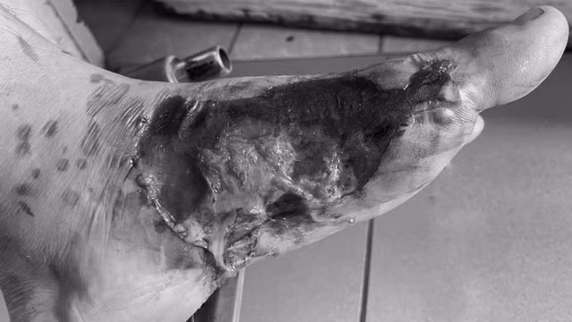 Hoai tu ban chan do chua bong theo loi thay lang