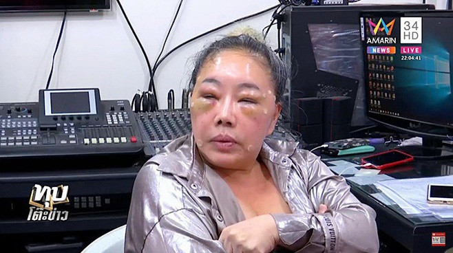 Một năm sau, Leena Jung lao vào giấc mộng làm đẹp nhưng thất bại. Suốt thời gian dài, nữ đại gia xuất hiện với gương mặt sưng phù, thâm tím và bầm dập.