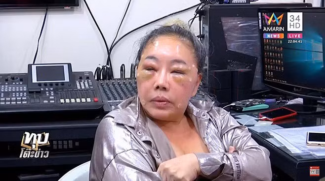 Một năm sau, Leena Jung lao vào giấc mộng làm đẹp nhưng thất bại. Suốt thời gian dài, nữ đại gia xuất hiện với gương mặt sưng phù, thâm tím và bầm dập.