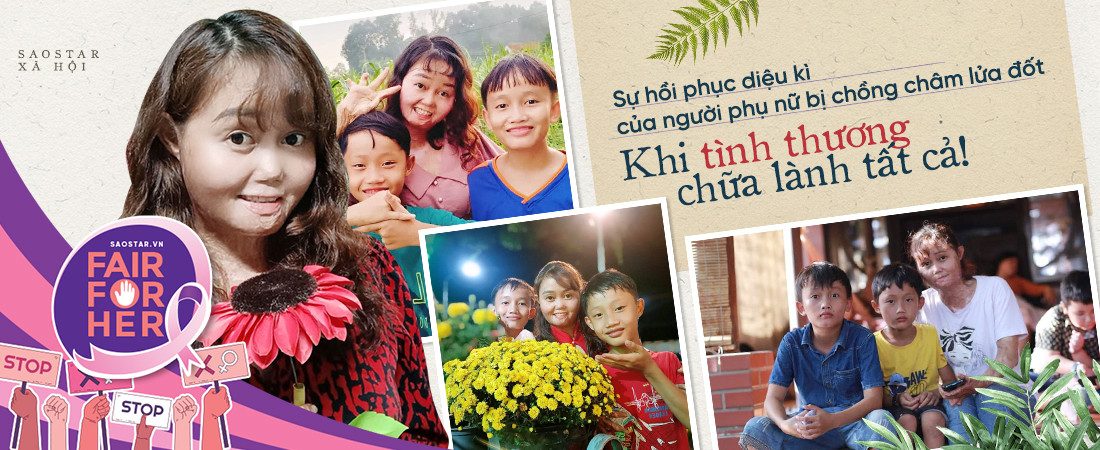 Sự hồi phục diệu kì của người phụ nữ bị chồng châm lửa đốt Su hoi phuc dieu ki cua nguoi phu nu bi chong cham lua dot