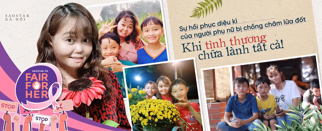 Su hoi phuc dieu ki cua nguoi phu nu bi chong cham lua dot