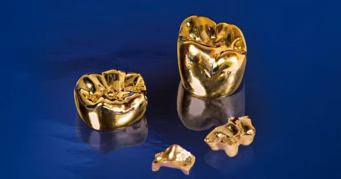 Bên cạnh đó, một số đại gia còn muốn đúc vàng nguyên khối bên trong chân răng. Ảnh minh hoạ