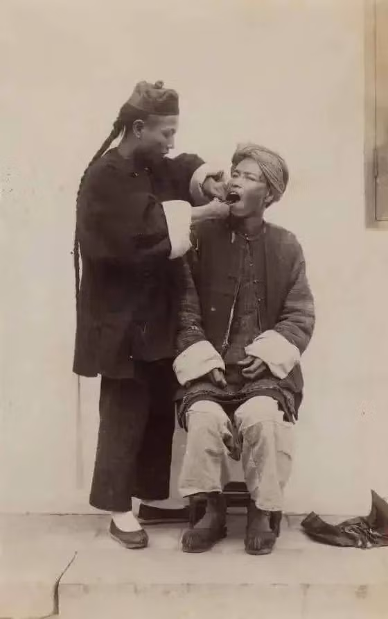 Nghề nhổ răng khá phổ biến trong xã hội Trung Quốc cuối thời nhà Thanh.