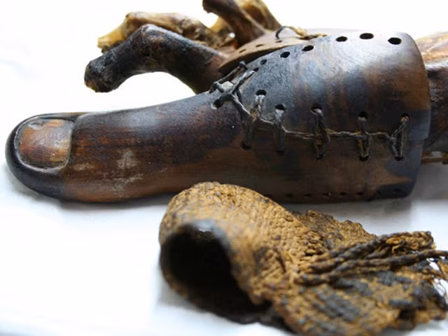 Các chuyên gia cho rằng, bộ phận cơ thể giả lâu đời nhất thế giới là 2 ngón chân giả được tìm thấy cùng với một xác ướp Ai Cập. Trong đó, một ngón chân giả được đặt tên là Greville Chester.