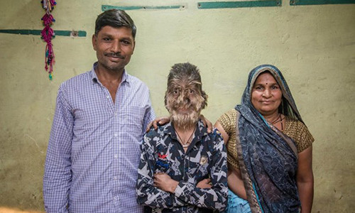 Cau be An Do mang khuon mat 