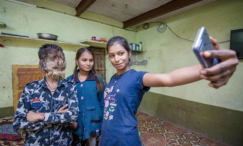 Cau be An Do mang khuon mat 