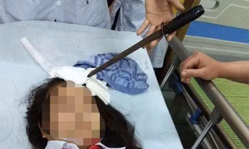 Em Hà nhanh chóng được đưa đến bệnh viện cấp cứu (ảnh GN)