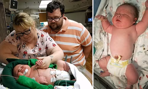 Be trai chao doi nang gan 7kg khien bac si tron mat