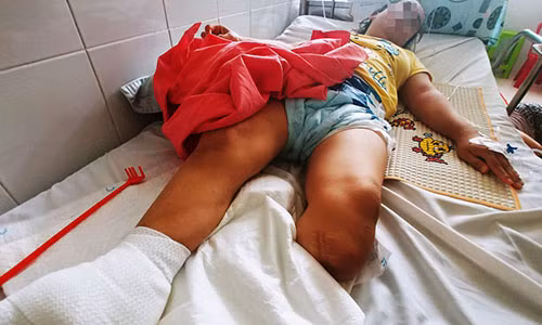 Nguoi phu nu 32 nam khong the di dung, phai cua chan