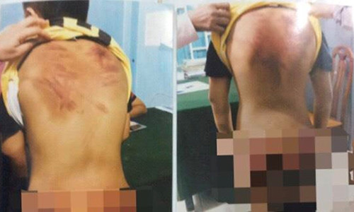 Thay tu bi to bao hanh tre em: Be trai 11 tuoi am anh moi khi di ngang chua