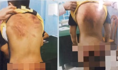 Thay tu bi to bao hanh tre em: Be trai 11 tuoi am anh moi khi di ngang chua