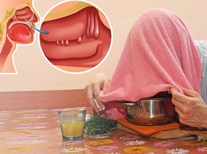 Dầu bạch đàn: Bạch đàn trong y học thảo dược đã được biết đến có thể giảm viêm và cải thiện tình trạng hô hấp. Dầu bạch đàn cũng có thể chống nhiễm trùng do vi khuẩn, virus và nấm, đồng thời giúp giữ cho đường hô hấp luôn sạch sẽ và ngăn ngừa chất nhầy. 