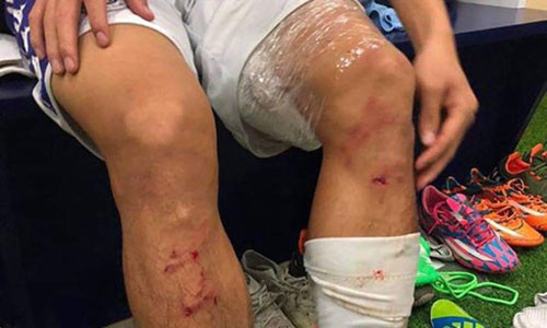 Trung ve Que Ngoc Hai dinh an phat nguoi cuc nang