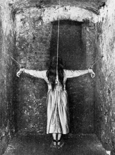 Một bệnh nhân đang được điều trị tâm thần ở Đức vào thế kỷ 19.