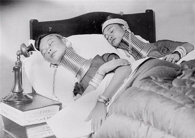 Hai người phụ nữ Miến Điện đeo những chiếc vòng kỳ lạ đang ngủ tại một khách sạn ở London năm 1930. 